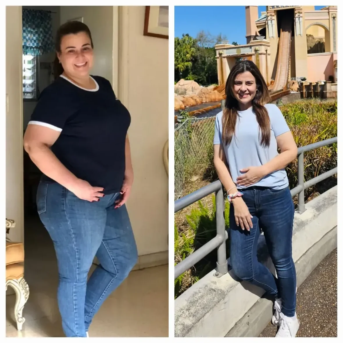 Transformación antes y después de paciente bariátrico