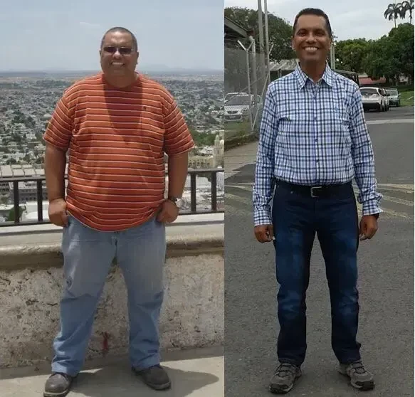 Resultado antes y después de paciente masculino