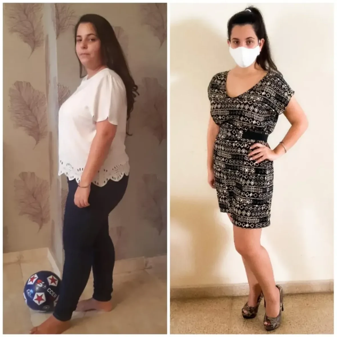 Historia antes y después de paciente femenina