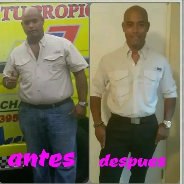 Antes y después de paciente masculino con pérdida de peso