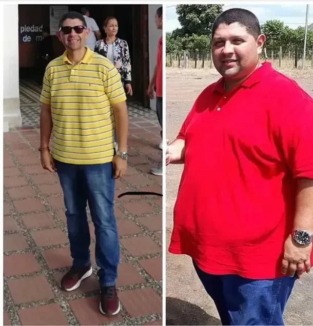 Paciente femenina antes y después en playa